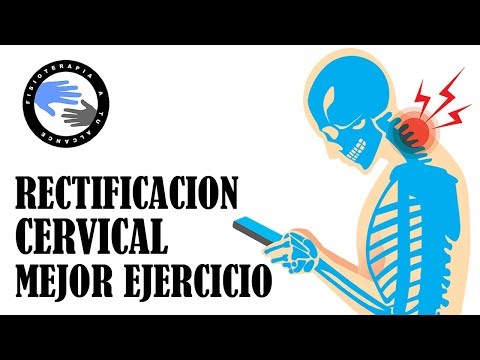 Rectificaci N Cervical Fisioterapia A Tu Alcance