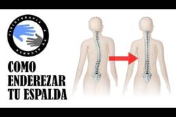 Como enderezar la espalda en los episodios de lumbalgia aguda, ejercicio para la espalda torcida