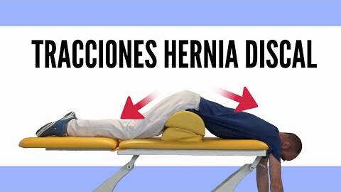 Hernia discal, 2 tracciones para descomprimir la columna lumbar