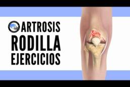 Ejercicios para tratar y evitarla artrosis de rodilla