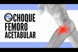 Choque femoroacetabular 5 ejercicios que te ayudaran a mejorar la movilidad y el dolor de cadera
