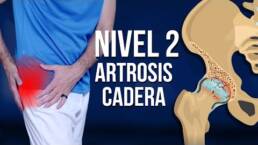 Rutina de ejercicios para la ARTROSIS de cadera en 20 minutos – NIVEL 2