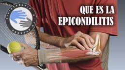 Epicondilitis o codo de tenista, que es y como se produce