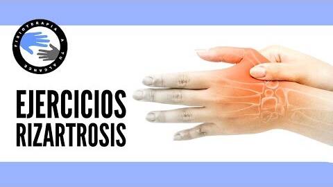 Ejercicios para la rizartrosis o artrosis del pulgar